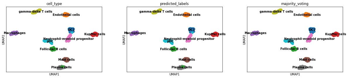 ../_images/notebook_celltypist_tutorial_59_0.png